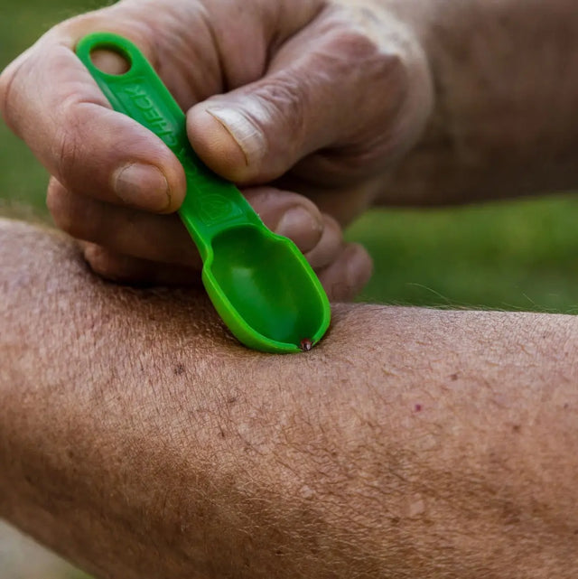Zeckenentferner Mensch und Tier Löffelset 3er mit Karabiner für Rucksack oder Hund von Tickcheck