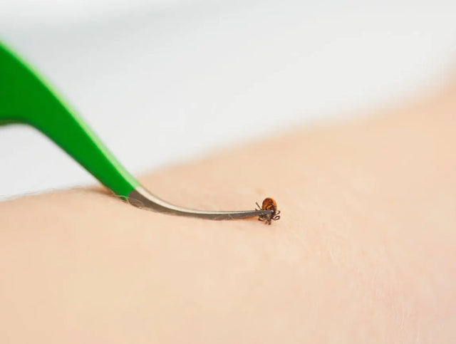 Premium Zeckenentferner Set Edelstahl mit Tasche für Mensch und Tier von Tickcheck