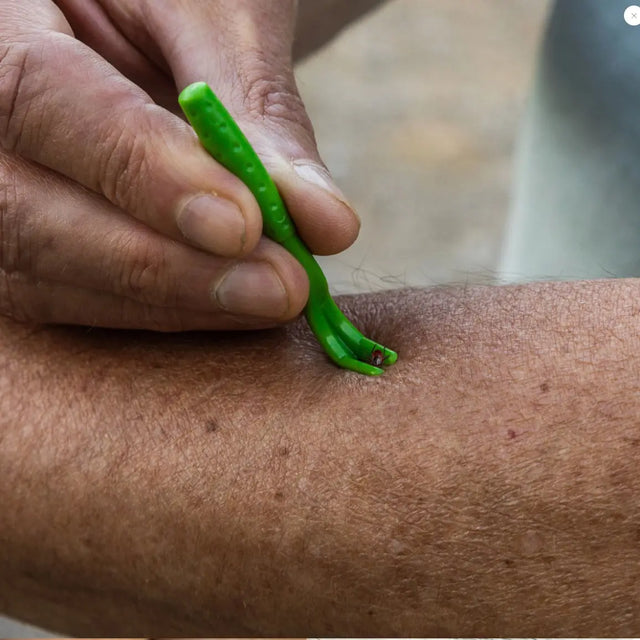 Zeckenentferner Familienpaket für Kinder und Erwachsene mit schliessbarem Beutel von Tickcheck