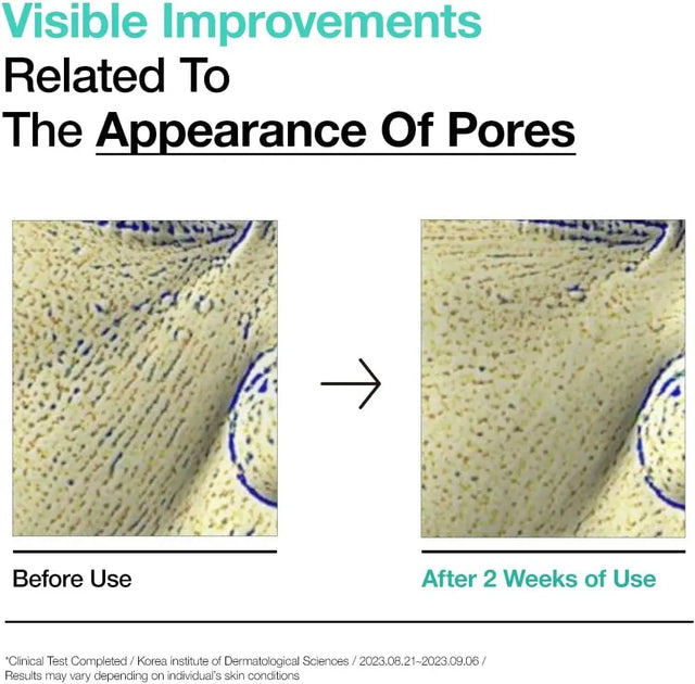 Peeling Toner Gesichtswasser Bha 150ml von Anua