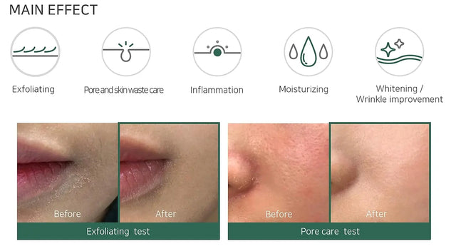 Toner Aha Bha Pha 150ml von Some by mi