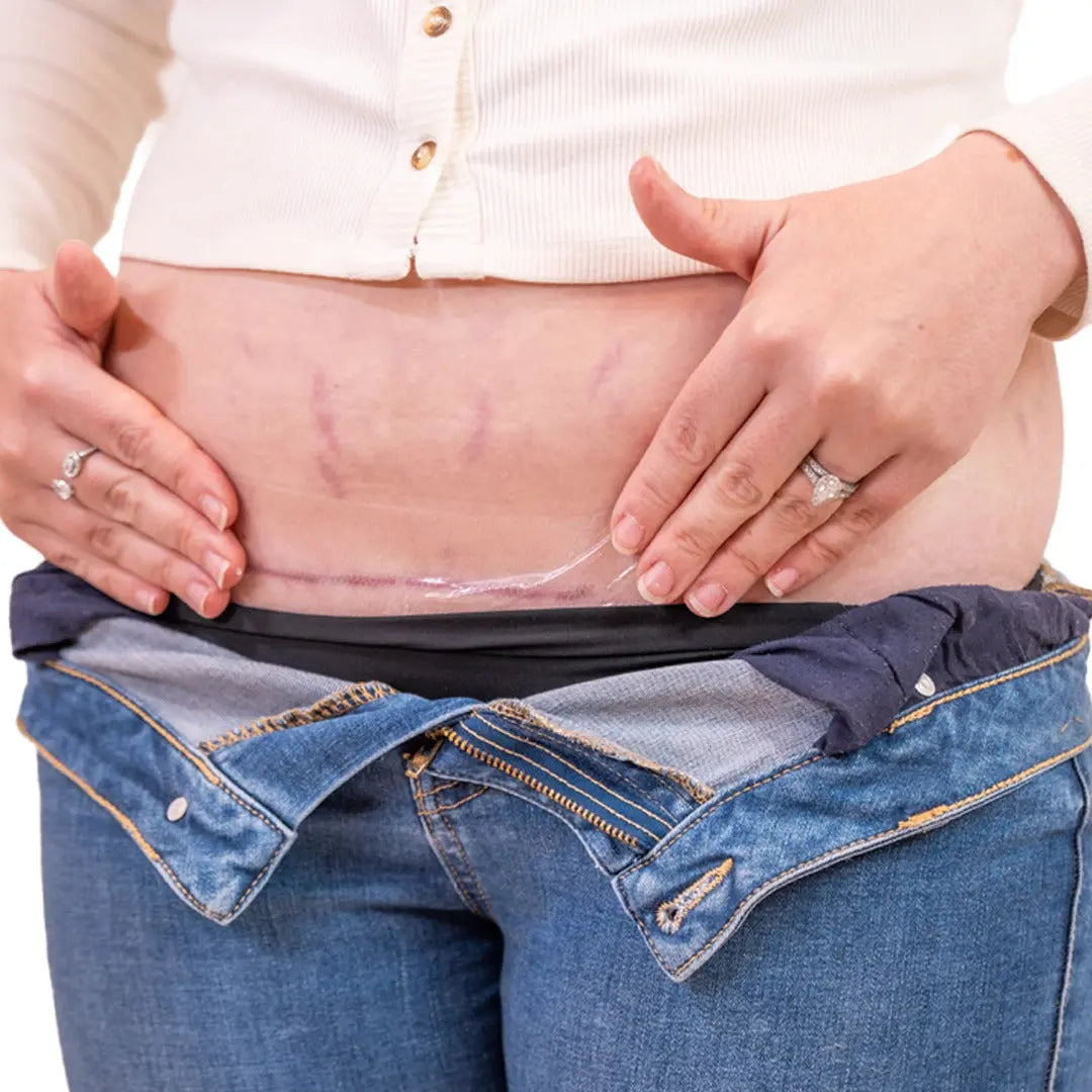 Narbenpflaster aus Silikon 6er Set von Booby Tape