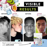 Fitness Kiwi Passionfruit Gum 100g Pack von JAWLINER