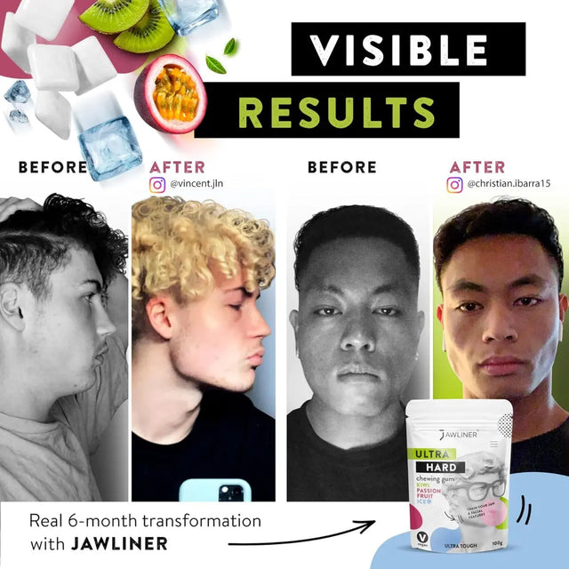 Fitness Kiwi Passionfruit Gum 100g Pack von JAWLINER